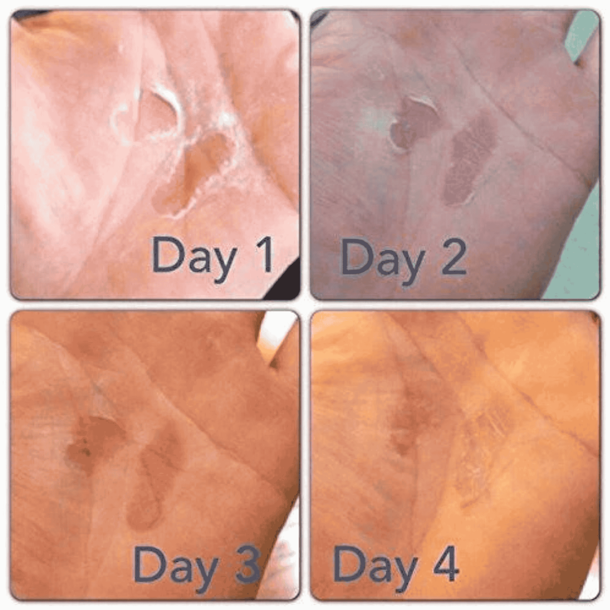 Rip Fix Hand Repair Results